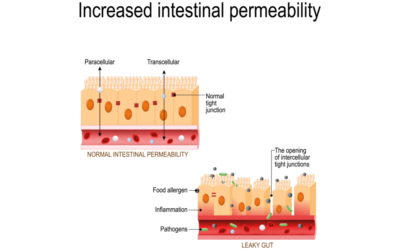 Does Leaky Gut Really Exist? Separating Myth from Reality